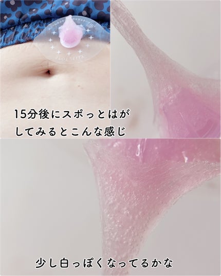 SPOT JELLY(スポッ!とジェリー)へそごまパック/花王/その他スキンケアを使ったクチコミ(6枚目)