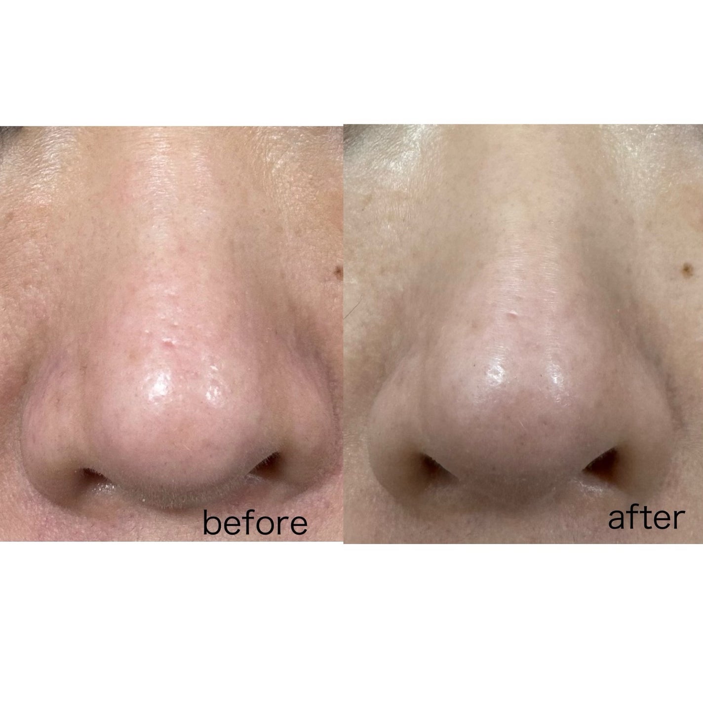 ソフィーナ iP ポア クリアリング ジェル ウォッシュ/SOFINA iP/その他洗顔料を使ったクチコミ(4枚目)