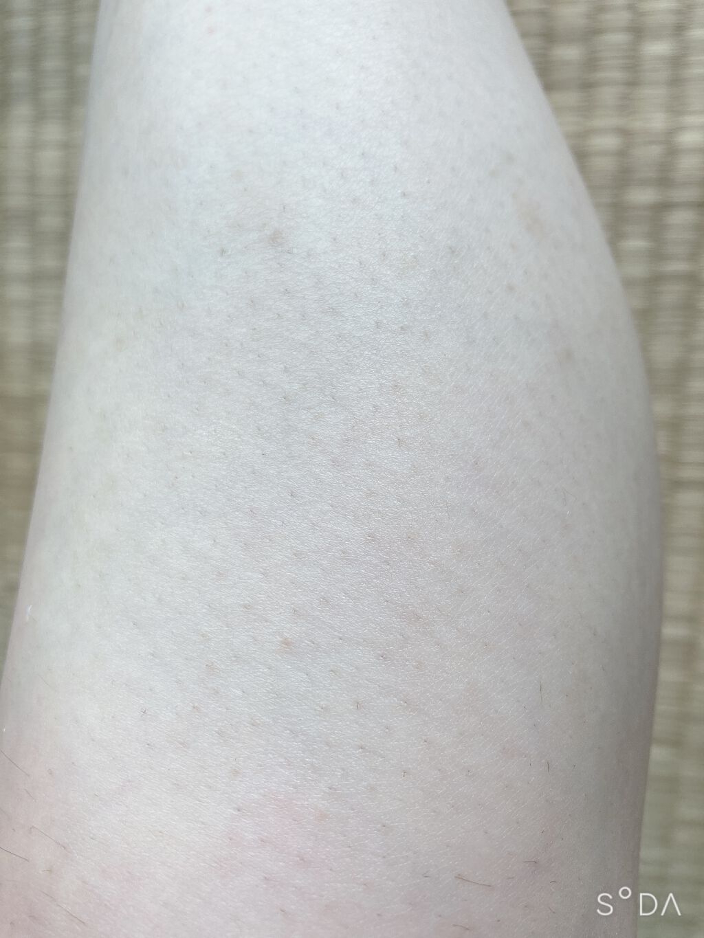 リムーバーフラペ/スージースタンド/除毛クリームを使ったクチコミ(7枚目)