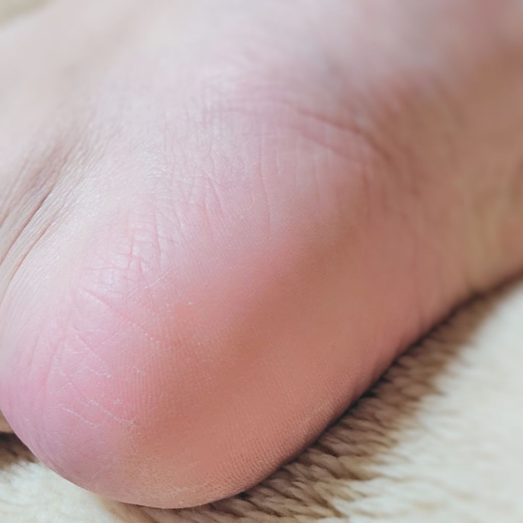 薬用 フットソープF1 フレッシュハーブ/フットメジ/レッグ・フットケアを使ったクチコミ（3枚目）