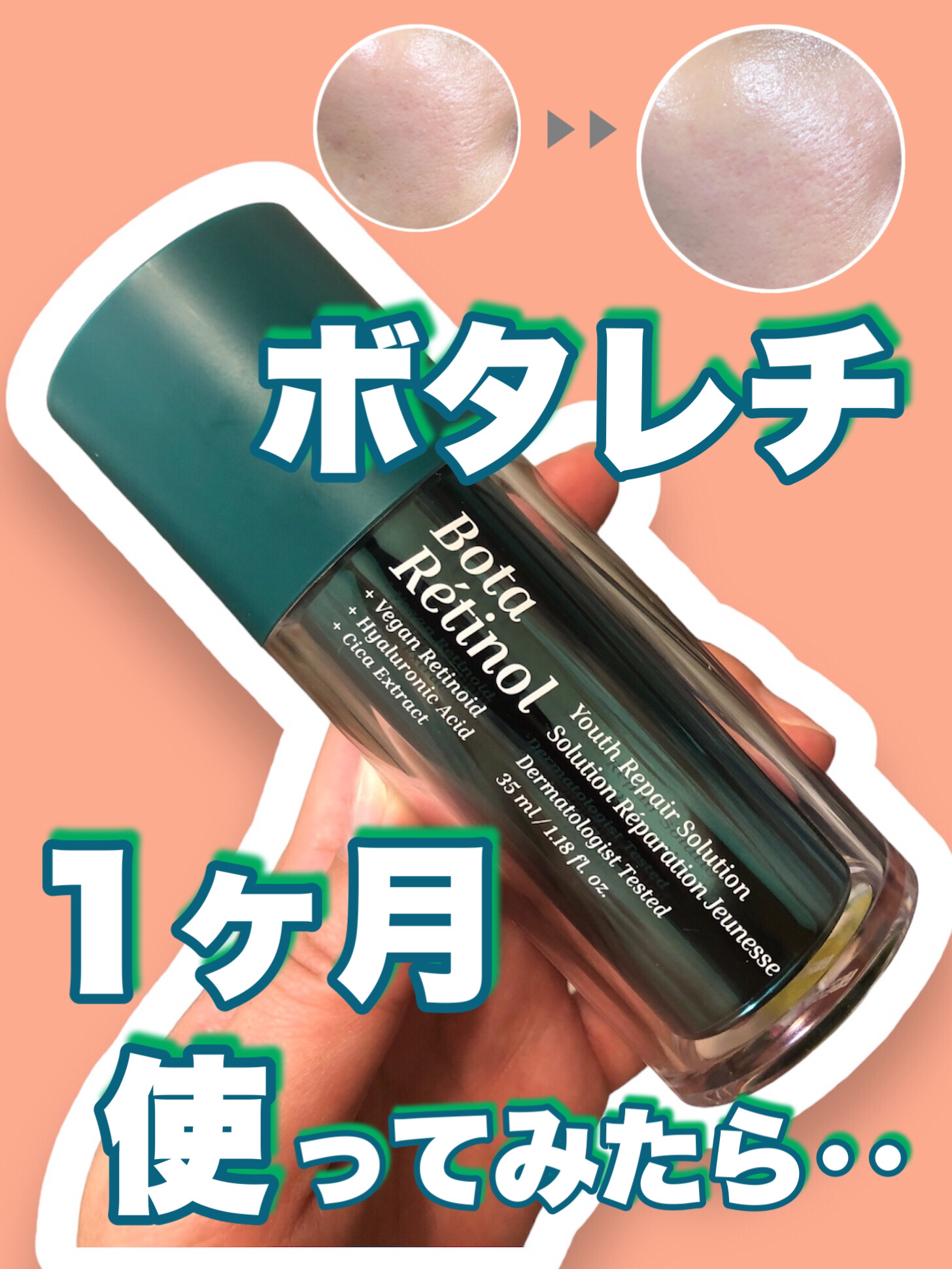 ボタレチノールユースリペアソリューションセット/ENPRANI（韓国）/美容液を使ったクチコミ（1枚目）