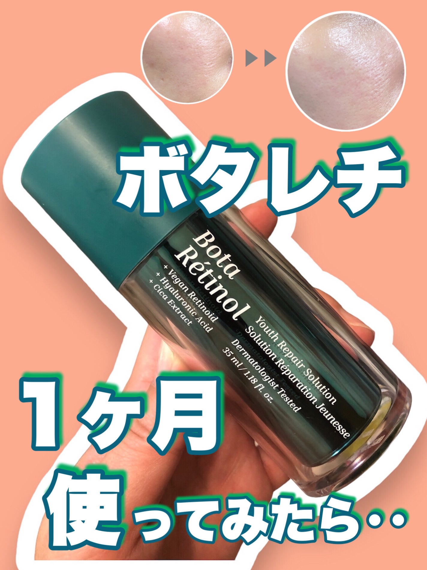 ボタレチノールユースリペアソリューションセット/ENPRANI(韓国)/美容液を使ったクチコミ(1枚目)