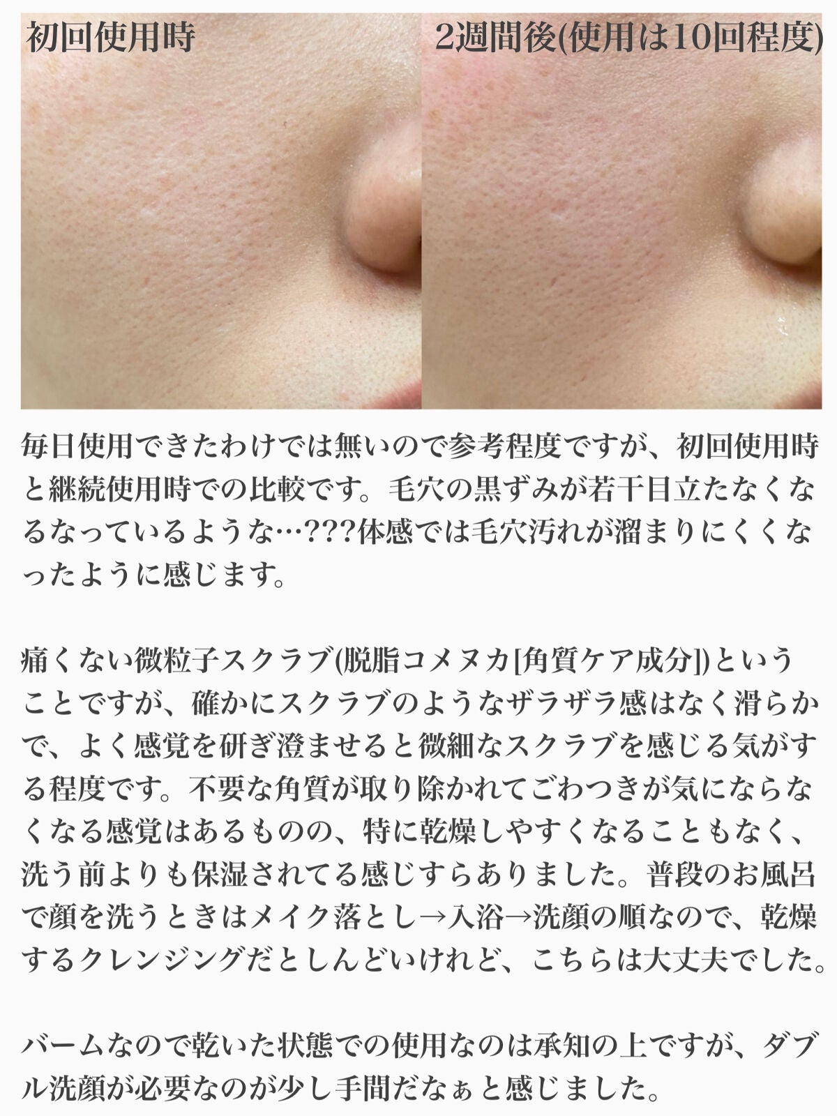 夢みるバーム ガスールブライトモイスチャー /ロゼット/クレンジングバームを使ったクチコミ(4枚目)