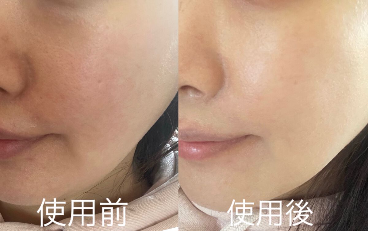 プロテーラービーグロウクッション ニュークラス/espoir/クッションファンデーションを使ったクチコミ（2枚目）