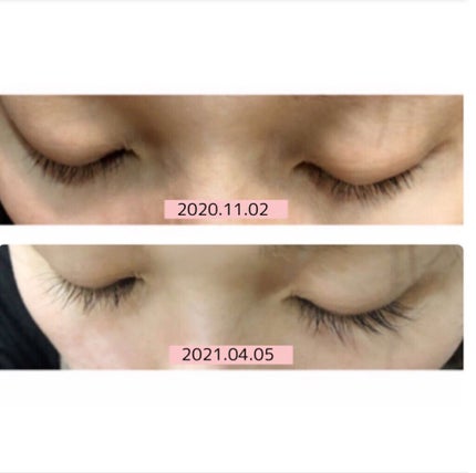 エグータム/アルマダスタイル/まつげ美容液を使ったクチコミ(6枚目)