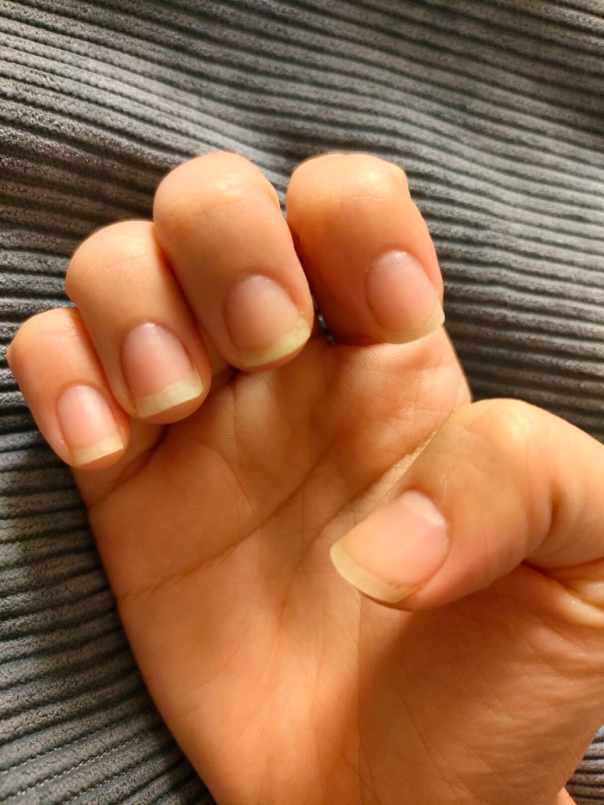 きくらげ on LIPS 「育爪日記vol.3んーあんまり前回の投稿と変わりないような、、..」(1枚目)