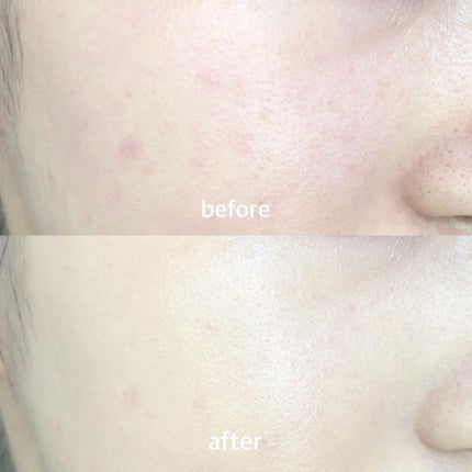 ピンクティーツリーカバークッション/APLIN/クッションファンデーションを使ったクチコミ(2枚目)