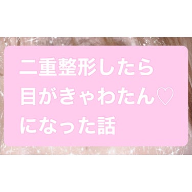 私事ではありますが先日、
二重埋没手術を受けて参りました！


結論、大大大満足です🤤🤤



私は元々一重なので毎日アイプチを
使って二重にしてましたが
その必要がなくなってメイク時間も短縮され最高で