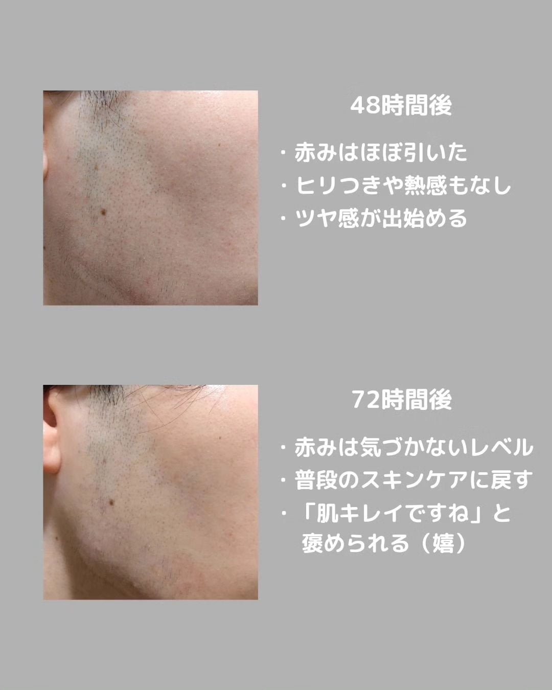 あき┃筋トレ美容家 on LIPS 「こんばんは、あきです!この前、人生初のポテンツァを受けてきまし..」(4枚目)