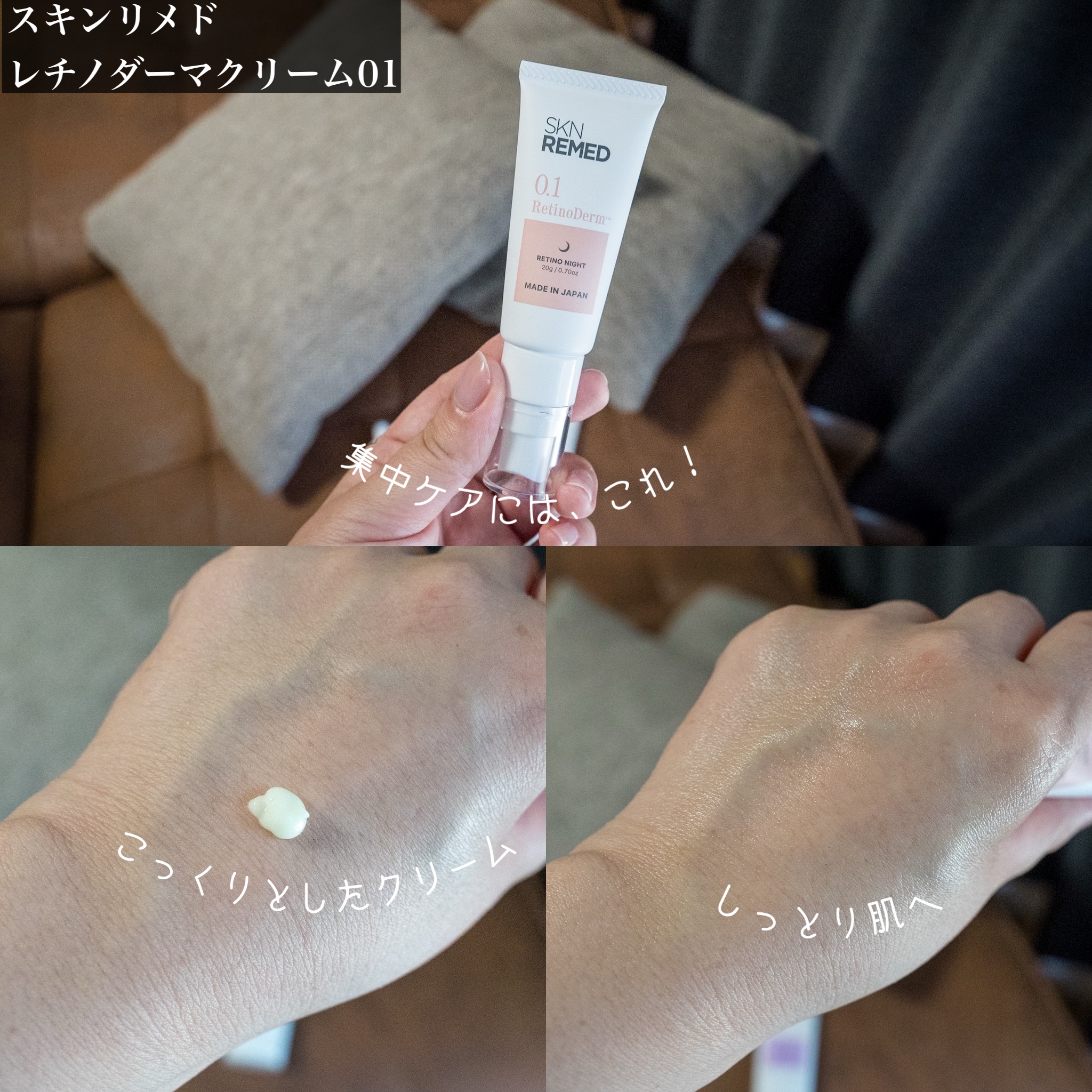 レチノダーマクリーム0.1/SKN REMED/フェイスクリームを使ったクチコミ（3枚目）