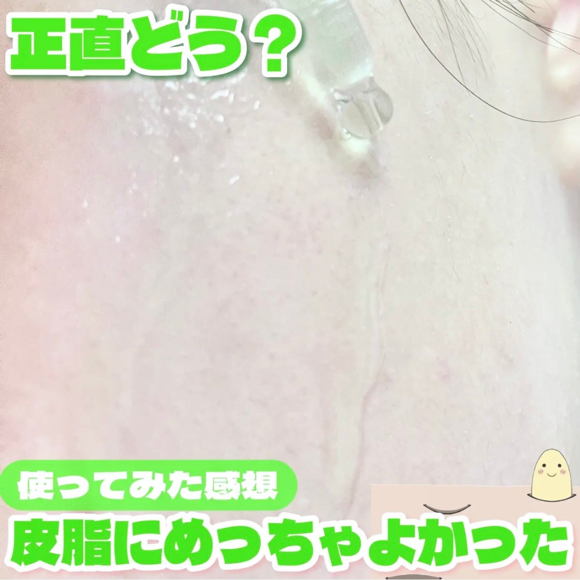 アゼライン酸15 インテンスカーミングセラム/Anua/美容液を使ったクチコミ(4枚目)