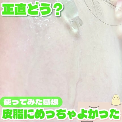 アゼライン酸15 インテンスカーミングセラム/Anua/美容液を使ったクチコミ(4枚目)