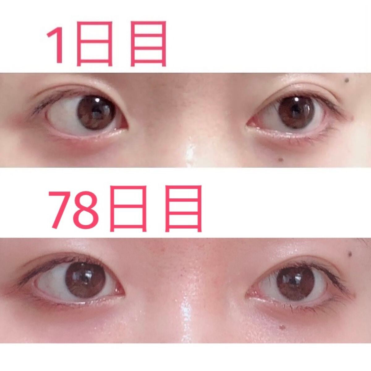 ラッシュアディクト アイラッシュコンディショニングセラム/soaddicted/まつげ美容液を使ったクチコミ(3枚目)