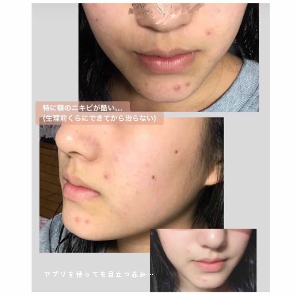 ハトムギ保湿ジェル(ナチュリエ スキンコンディショニングジェル)/ナチュリエ/美容液を使ったクチコミ（2枚目）