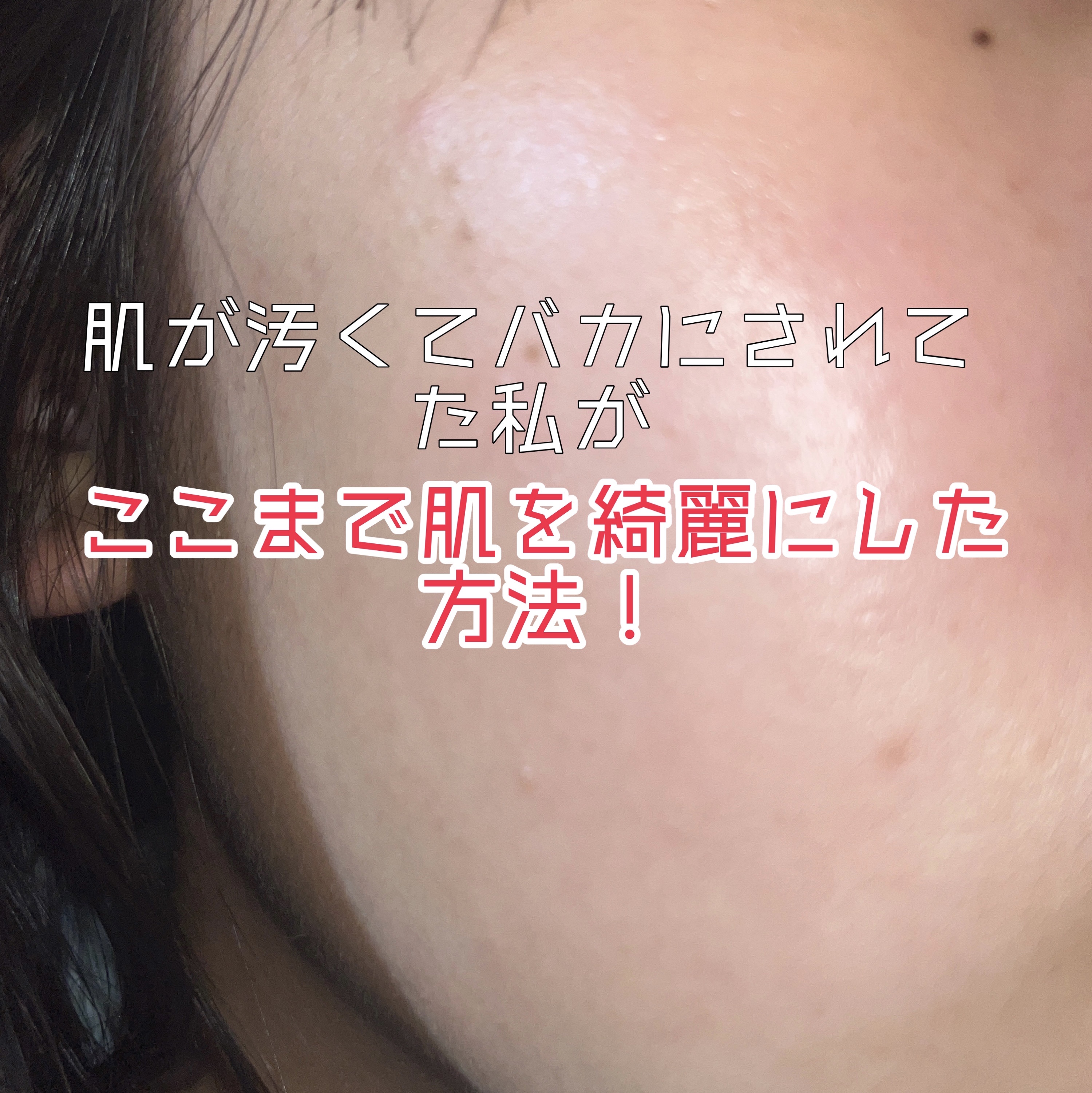 白潤 薬用美白化粧水(しっとりタイプ)/肌ラボ/化粧水を使ったクチコミ（1枚目）