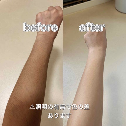 除毛クリームキット敏感肌用/エピラット/除毛クリームを使ったクチコミ(2枚目)