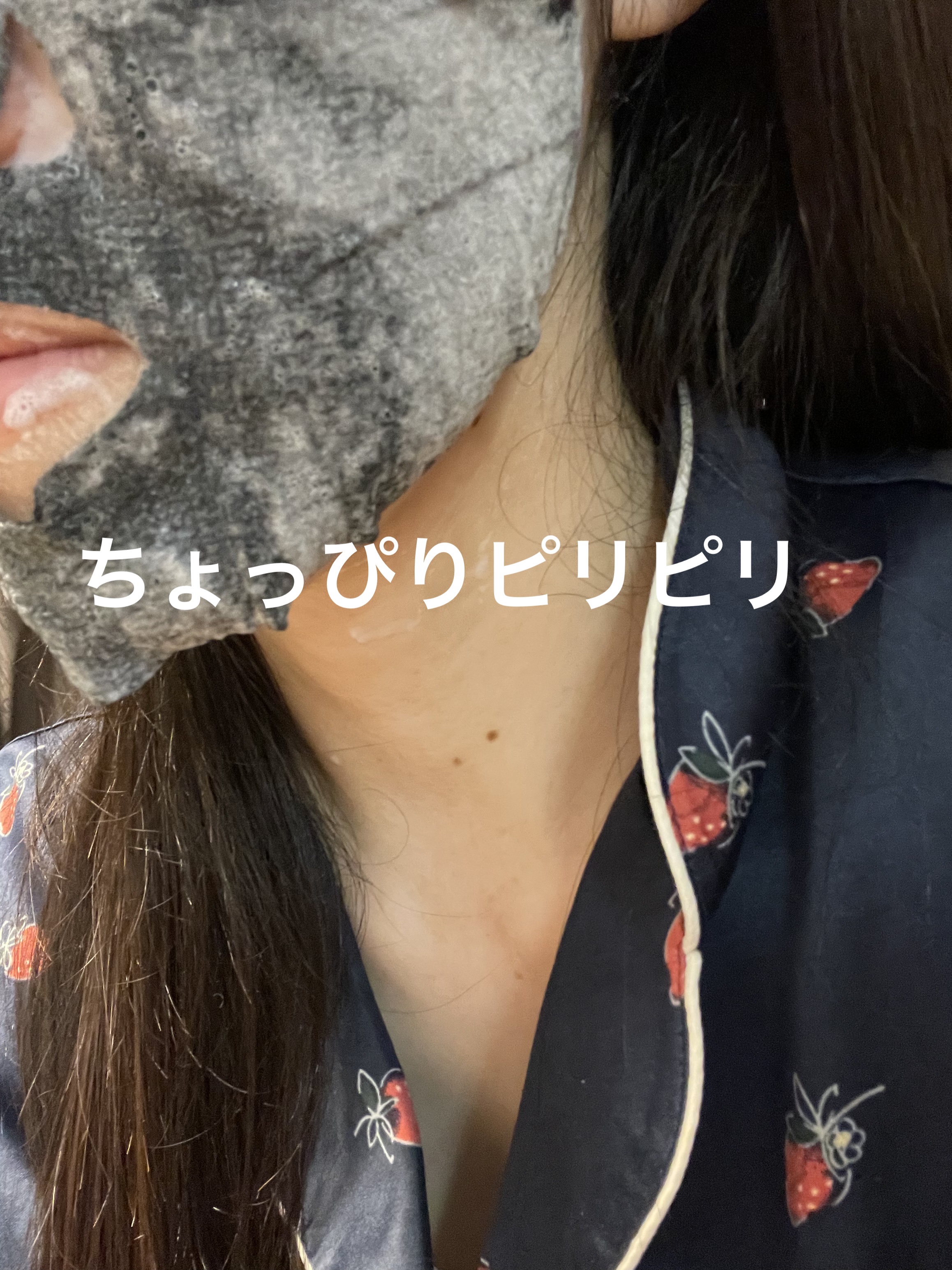 ブライトニング バブルトックス セラムマスク 3枚/MEDIHEAL/シートマスク・パックを使ったクチコミ（2枚目）