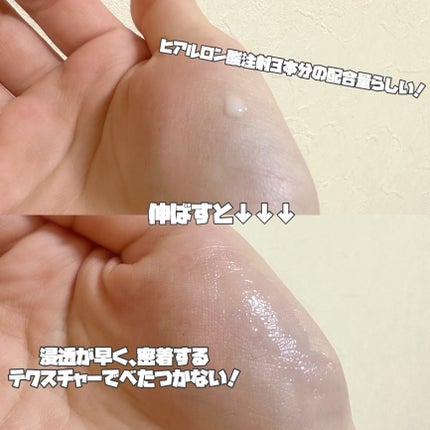 カプチュール トータル ヒアルショット/Dior/美容液を使ったクチコミ(3枚目)