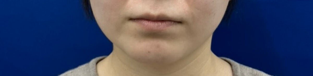 ãœãðãã©ãã100 on LIPS ãé¡äžã®èèªåžåŒãšç³žãªããããã£ãŠããŸãã^^åèã«ããŠããã ã..ãïŒ2æç®ïŒ