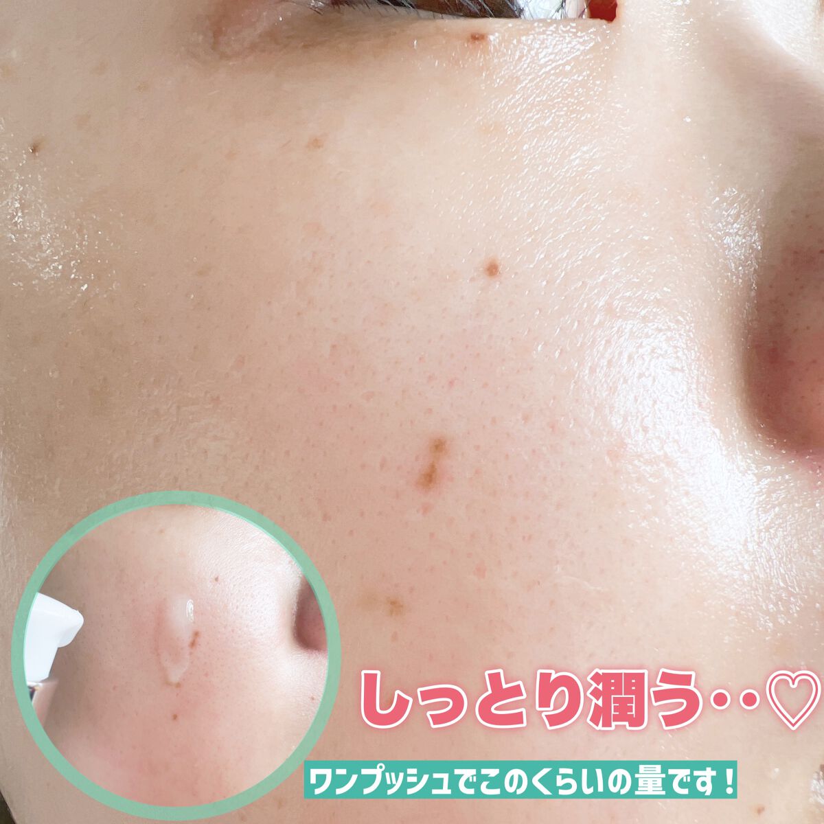 エイシカ365 ブレミッシュカーミングセラム/AESTURA/美容液を使ったクチコミ(6枚目)