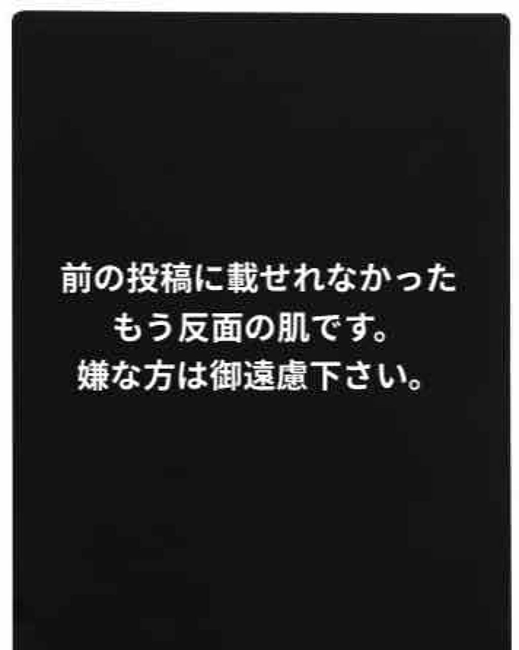 プロポリス エネルギーアンプル/CNP Laboratory/美容液を使ったクチコミ(2枚目)