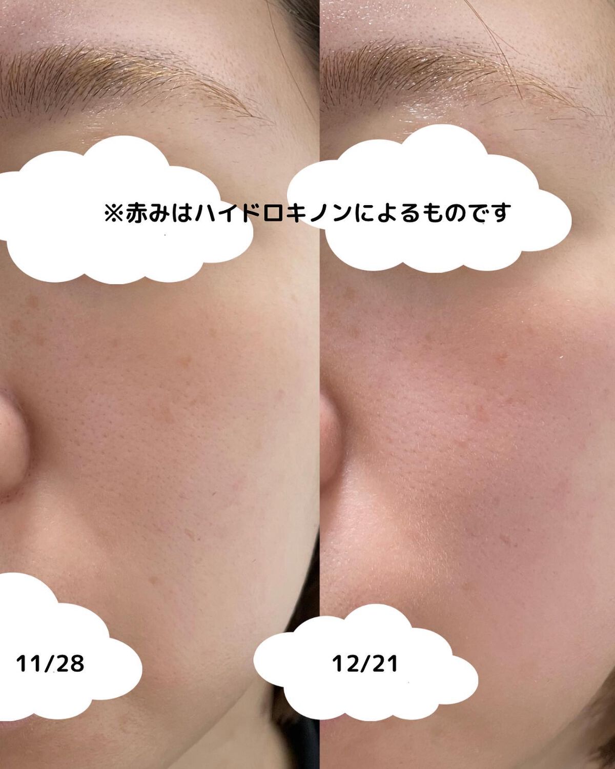 ミシャ ビタシープラス 美容液【日本処方】/MISSHA/美容液を使ったクチコミ(2枚目)