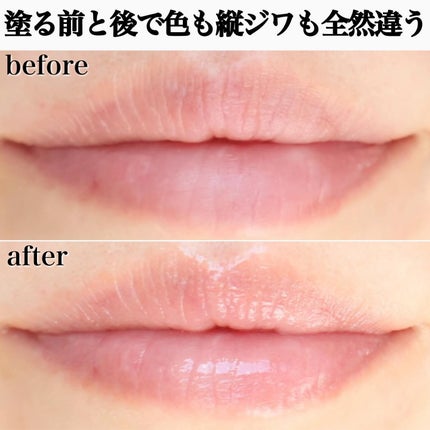 コスメデコルテ リポソーム アドバンスト リペアリップセラム/DECORTÉ/リップ美容液を使ったクチコミ(4枚目)