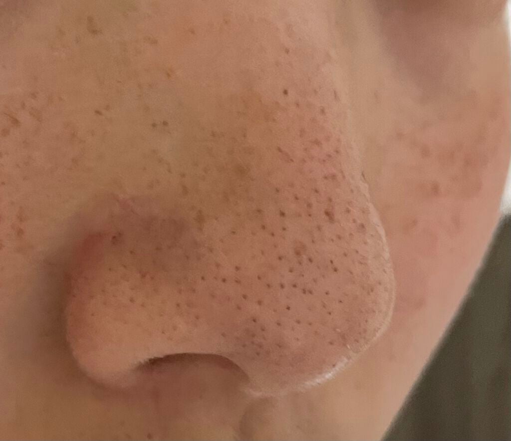 ノーモアブラックヘッド(ノーズピーリング)/One-day's you/スクラブ・ゴマージュを使ったクチコミ(8枚目)