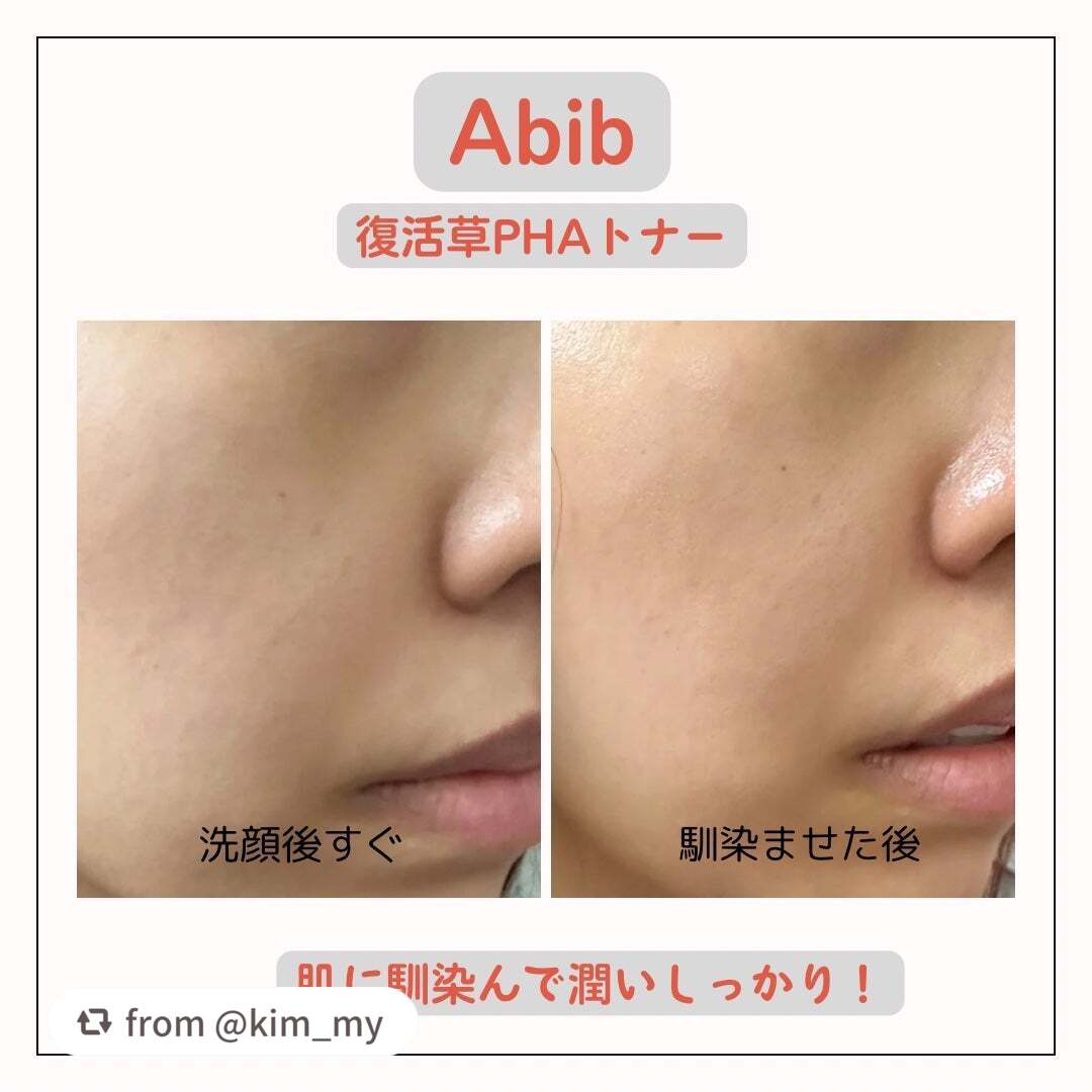 復活草PHAトナー スキンブースター/Abib /化粧水を使ったクチコミ(2枚目)