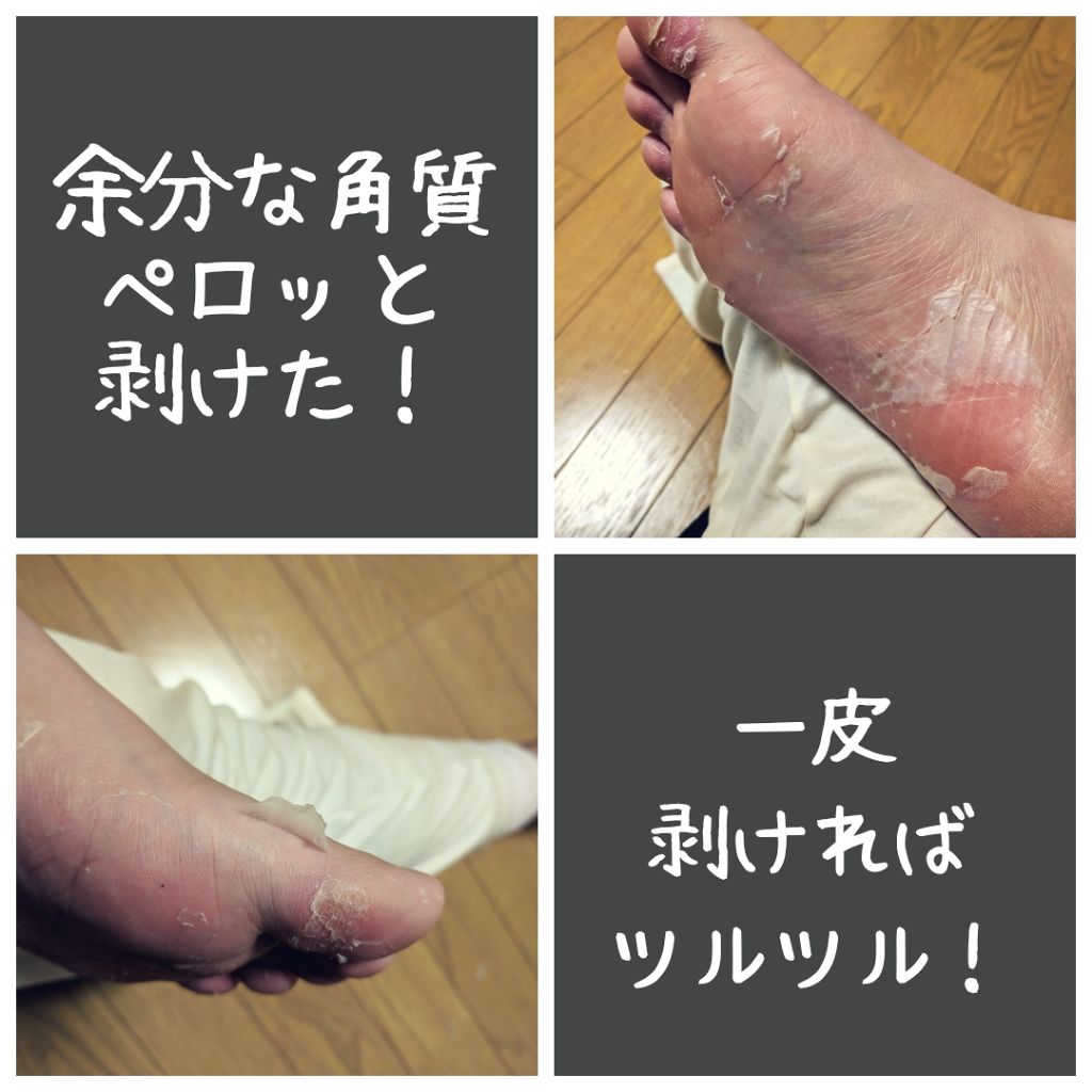 390円 公式ストア メール便 送料無料 ミジンケア 足角質ケア Mjcare 韓国コスメ ソフト