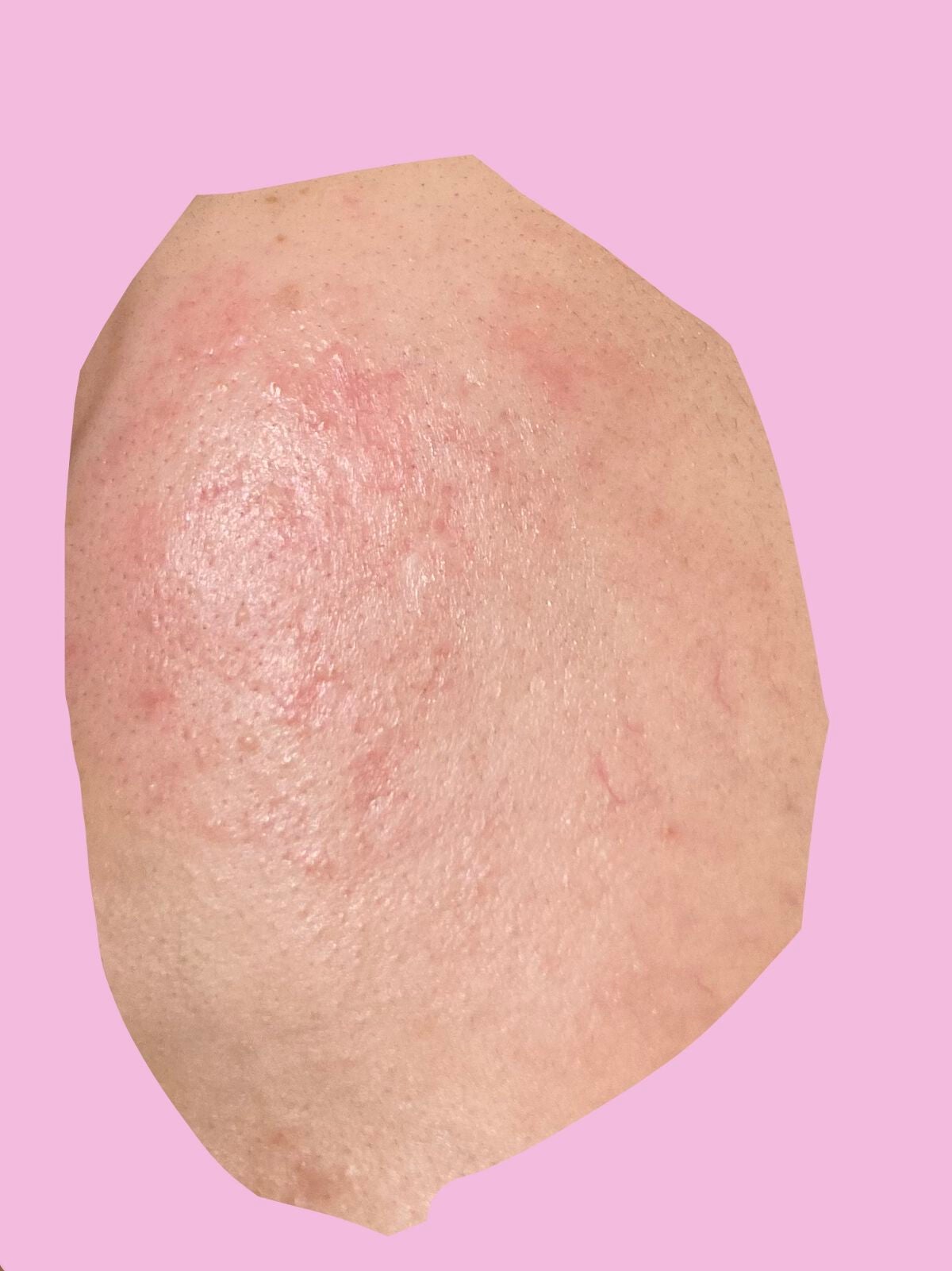 極潤 薬用ハリ化粧水【医薬部外品】/肌ラボ/化粧水を使ったクチコミ(2枚目)