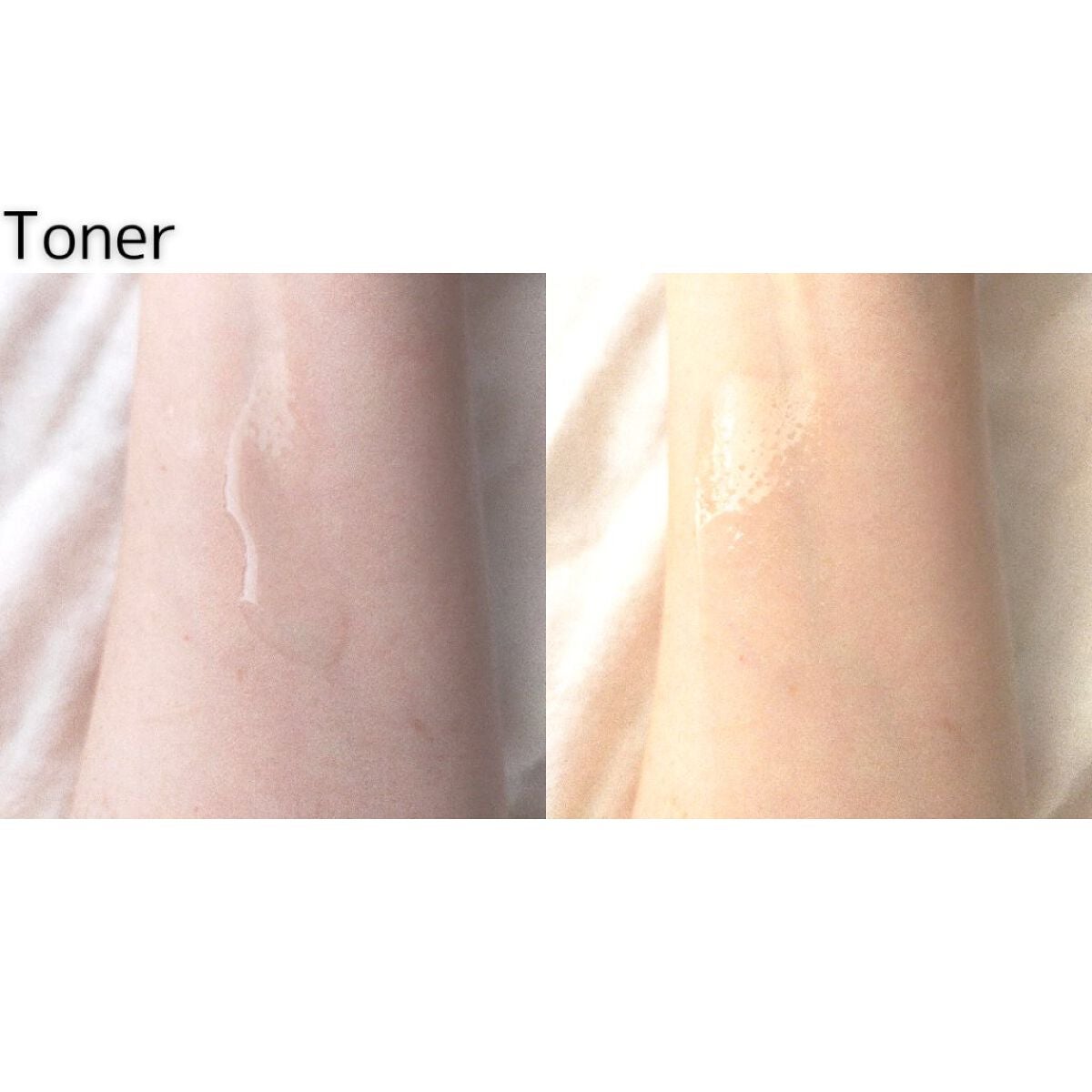 スーパーシカトナー/MEDICUBE/化粧水を使ったクチコミ(2枚目)