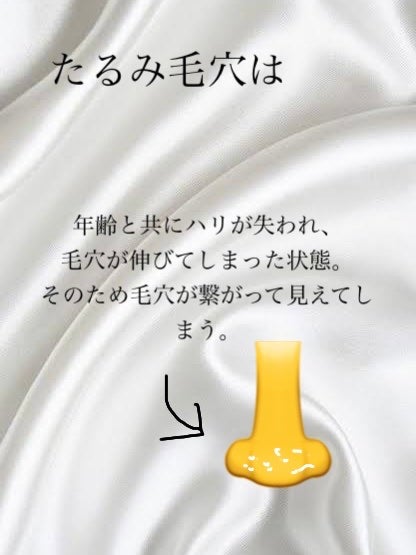 ハトムギ化粧水(ナチュリエ スキンコンディショナー R )/ナチュリエ/化粧水を使ったクチコミ(5枚目)