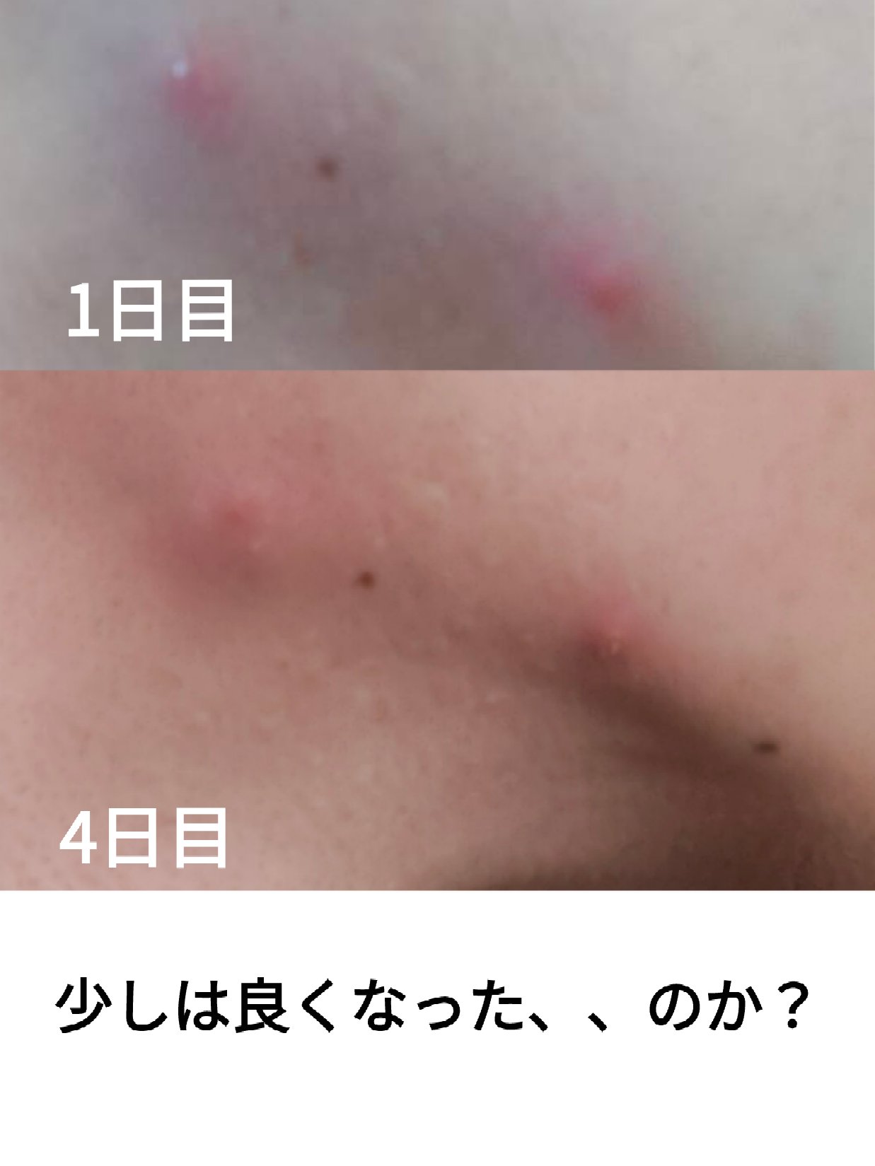 メンズビオレ ザフェイス　毛穴汚れクリア/メンズビオレ/泡洗顔を使ったクチコミ（2枚目）