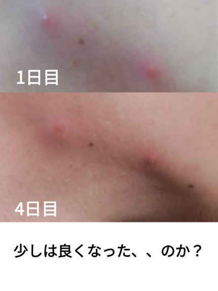 メンズビオレ ザフェイス 毛穴汚れクリア/メンズビオレ/泡洗顔を使ったクチコミ(2枚目)