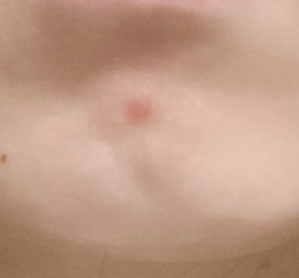 ハトムギ浸透乳液(ナチュリエ スキンコンディショニングミルク)/ナチュリエ/乳液を使ったクチコミ(2枚目)