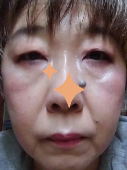 マスクフィットオールカバーデュアルコンシーラー/TIRTIR(ティルティル)/コンシーラーを使ったクチコミ(3枚目)