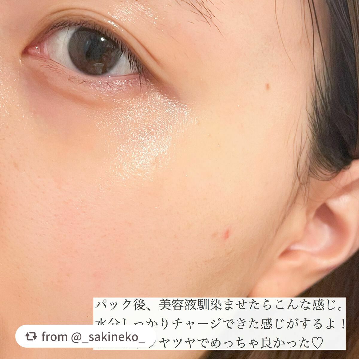 THE N.M.F APマスクJEX/MEDIHEAL/シートマスク・パックを使ったクチコミ(6枚目)