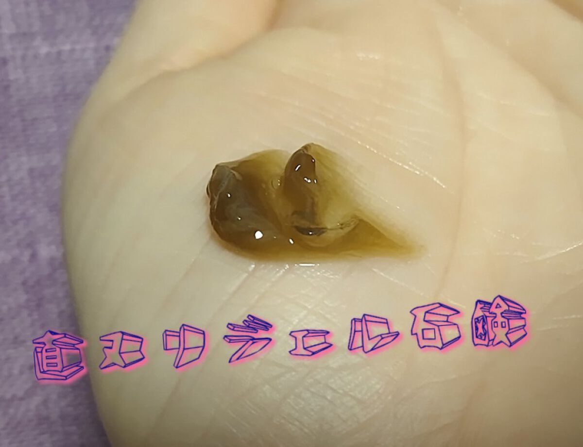 薬用ソフトストーンＷ/デオナチュレ/デオドラント・制汗剤を使ったクチコミ（2枚目）