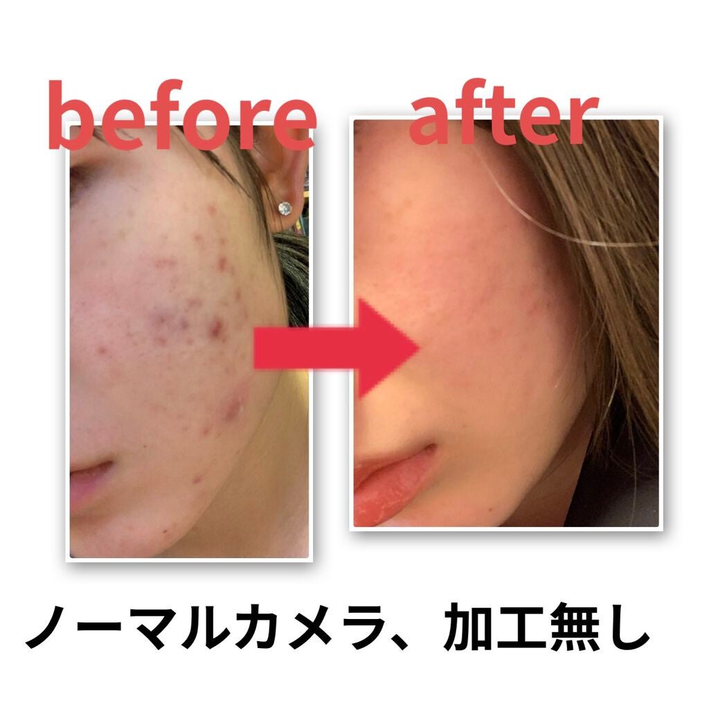 白色ワセリン(医薬品)/健栄製薬/その他を使ったクチコミ(2枚目)