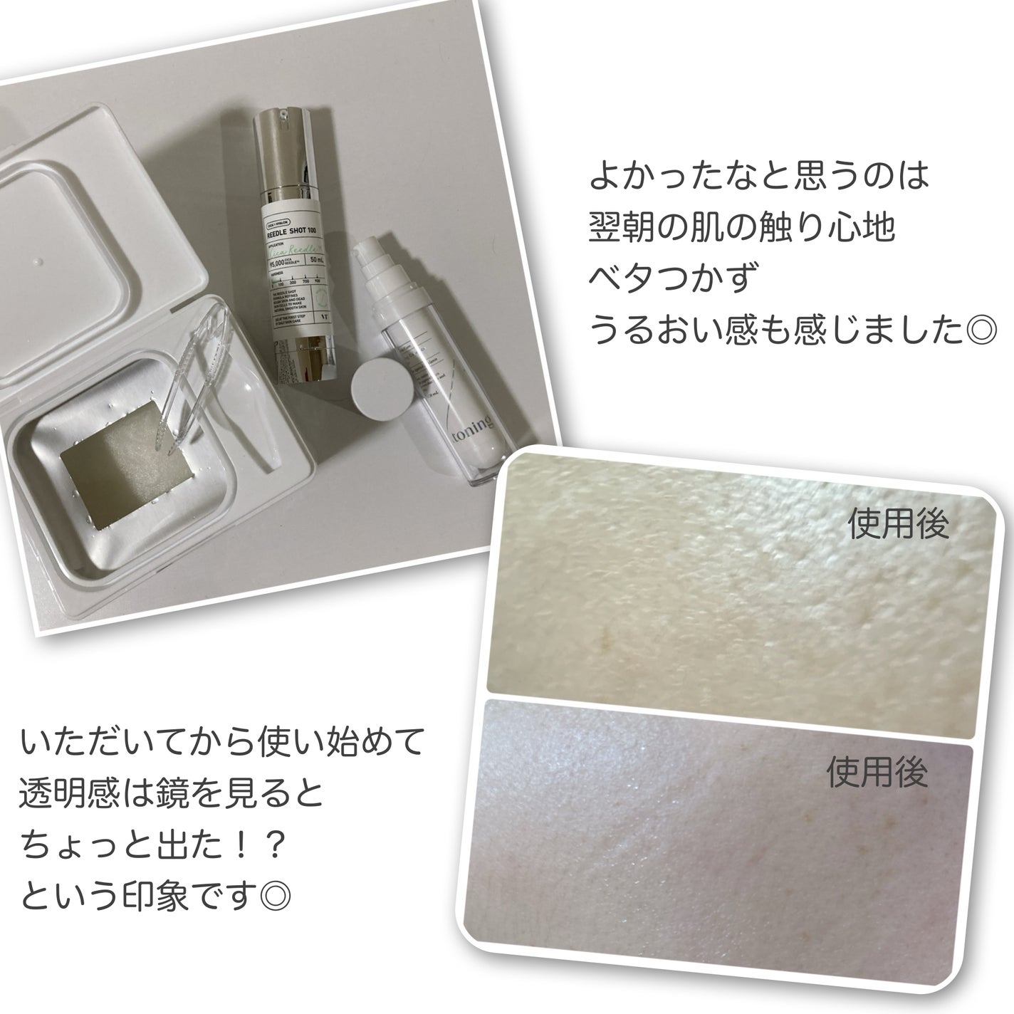 リードルショット100/VT/美容液を使ったクチコミ(5枚目)