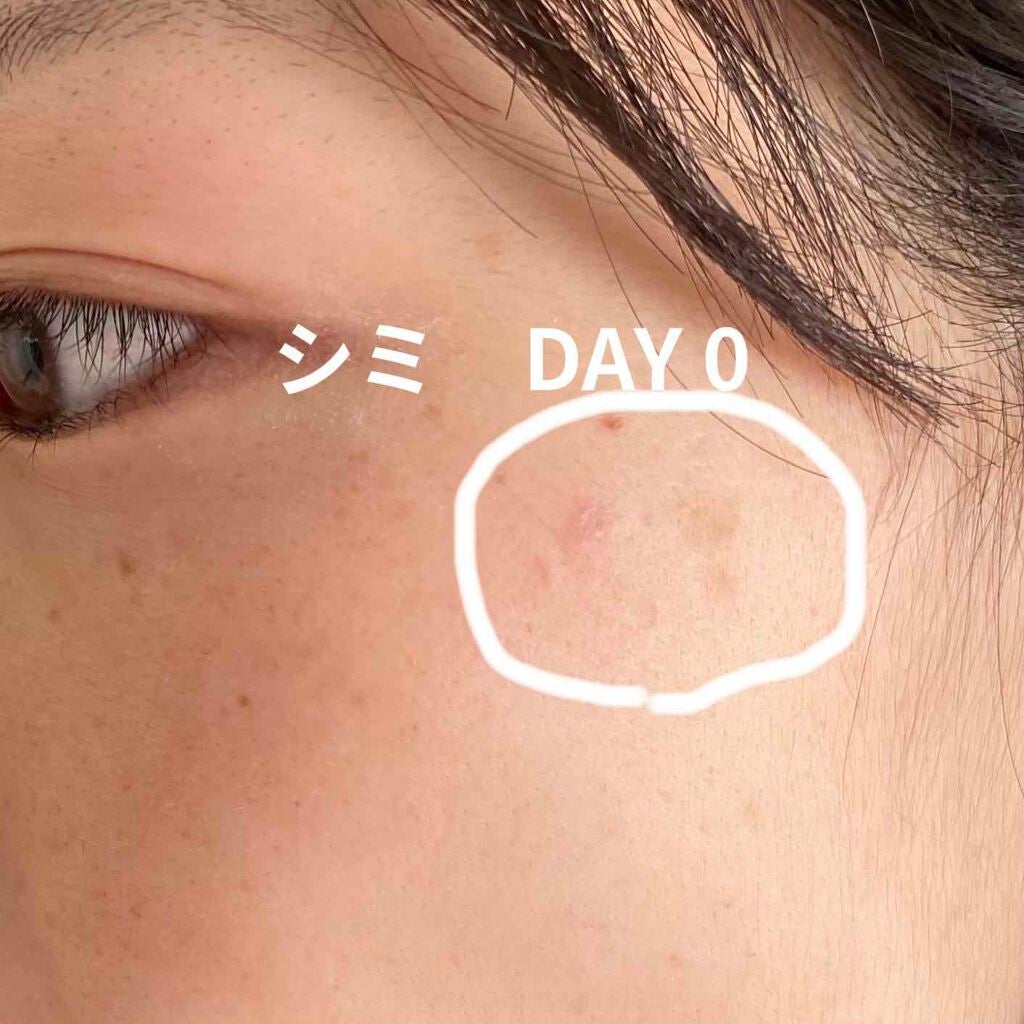 ハイチオールCホワイティア(医薬品)/ハイチオールC/その他を使ったクチコミ(4枚目)
