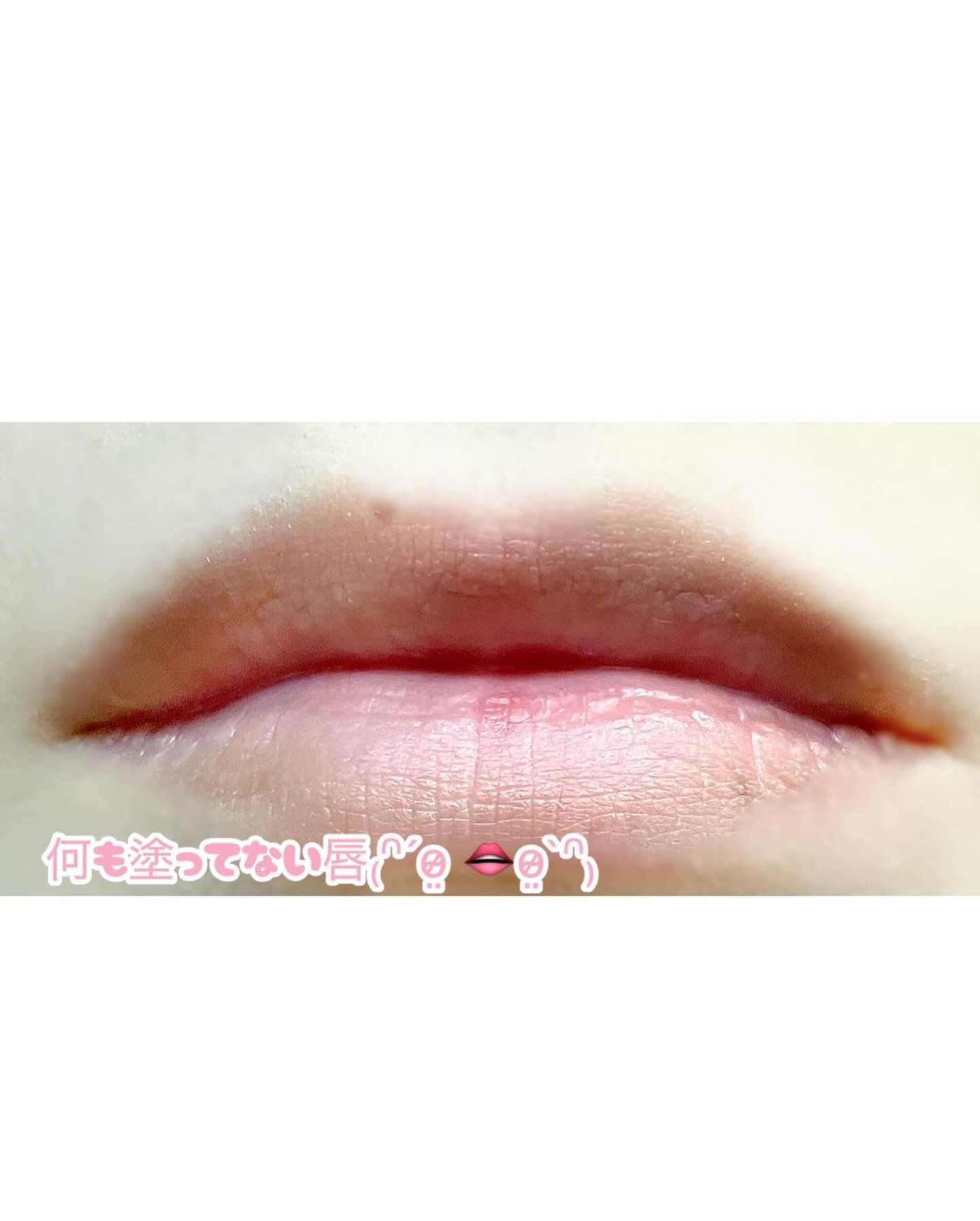 キューミ―ボムショットリッププランパー/AGARISM/リッププランパーを使ったクチコミ（2枚目）