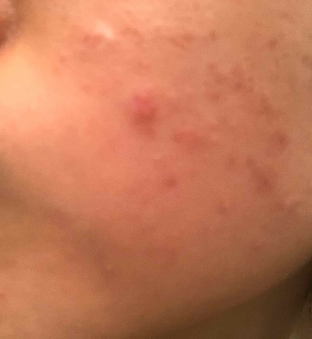 ビジャ シカバーム EX/innisfree/フェイスバームを使ったクチコミ（2枚目）