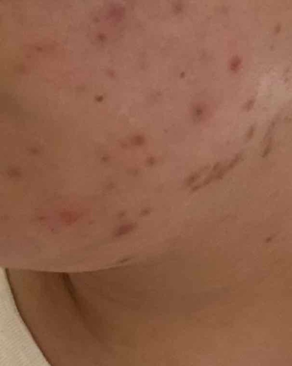 パワーマスク/ラッシュ/洗い流すパック・マスクを使ったクチコミ（3枚目）