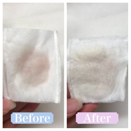 ネイチャーコンク 薬用クリアローション/ネイチャーコンク/拭き取り化粧水を使ったクチコミ(2枚目)