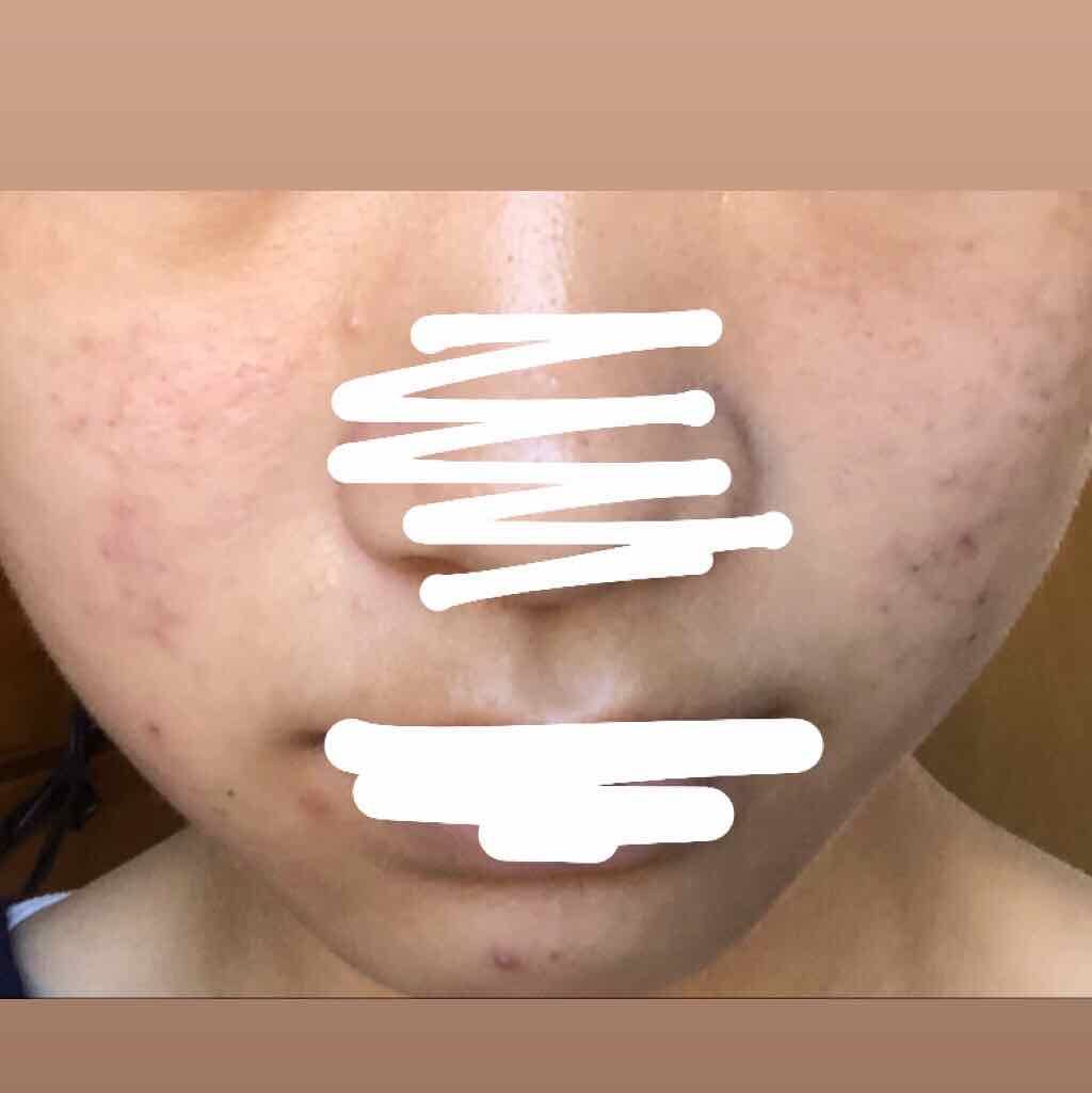 ドクタージャルト シカペア クリーム （第2世代）/Dr.Jart＋/フェイスクリームを使ったクチコミ（3枚目）