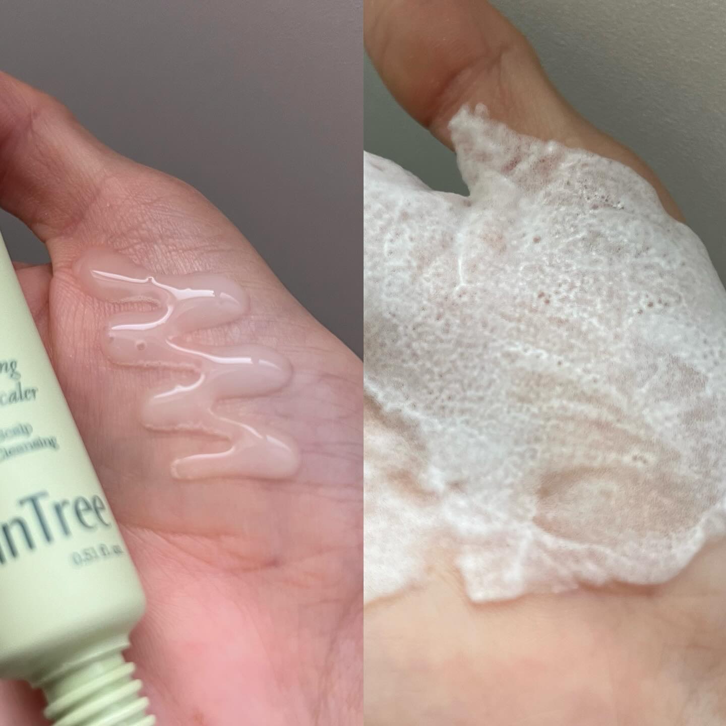 スパークリングスカルプスケーラー/ミンツリー/頭皮ケアを使ったクチコミ（2枚目）