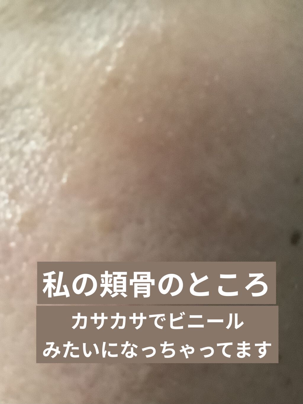 キュアレア（医薬品）/キュアレアa/その他を使ったクチコミ（2枚目）