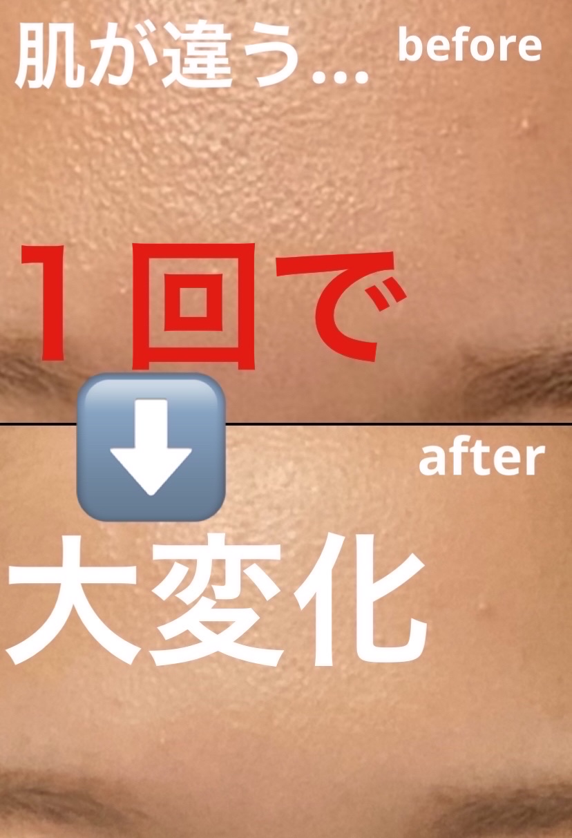 マンデリック インテンシブ 18%セラム/DR.WU/美容液を使ったクチコミ（1枚目）